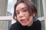 Kiss