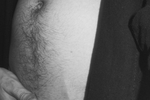 prince — Nudes of my Trans*body in B/W