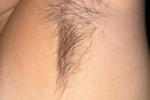 My MOST hairy armpits EVER! (3 months and 22 days)