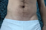 Bulge