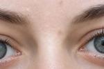 blue eyes