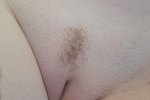 Pussy Pics - Landing Strip