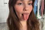 Braces Tease