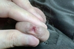 My penis close-ups