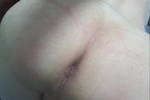 Fuckhole Pics