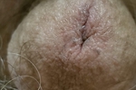 Just the head