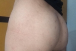 🥵