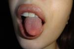 lips)