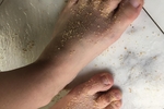 Dirty feet.