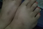 Angelbugs feet