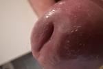Closeups
