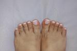 feet and nails