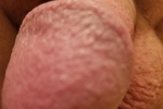More.....