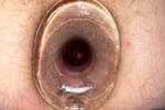 Pics