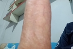 huog dick