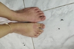 Feet