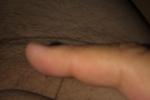 winner of micropenis month