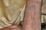 Getting Hard
