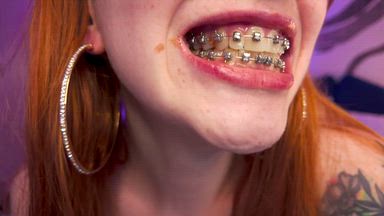 Braces Fetish Close-Up