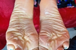 soles oil