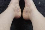 aura cristina๐ โ My delicious feet ๐ฃ