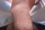 xx