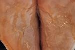 Honie feet's