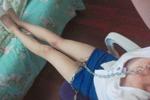 ada โ My leg