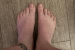 Feet