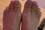 feet