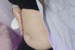 Tummy ✨