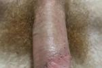 nudes
