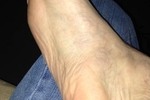 my feet