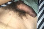 Dick