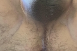BP