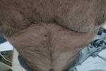 Hairy chest