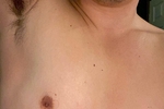 Armpit