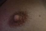 phil โ Nipple