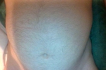 Belly