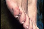 Feet set