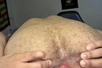 Butthole
