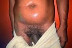 Hairy Bush