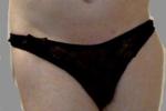 Other photos