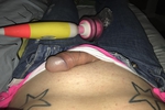 Boyclit stimulation