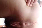 My hairy butthole