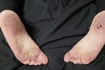 Dirty feet