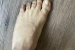 feet