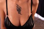 Breast Aesthetics
