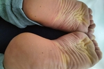 Wrinkled soles