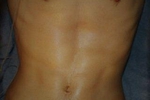 Abs